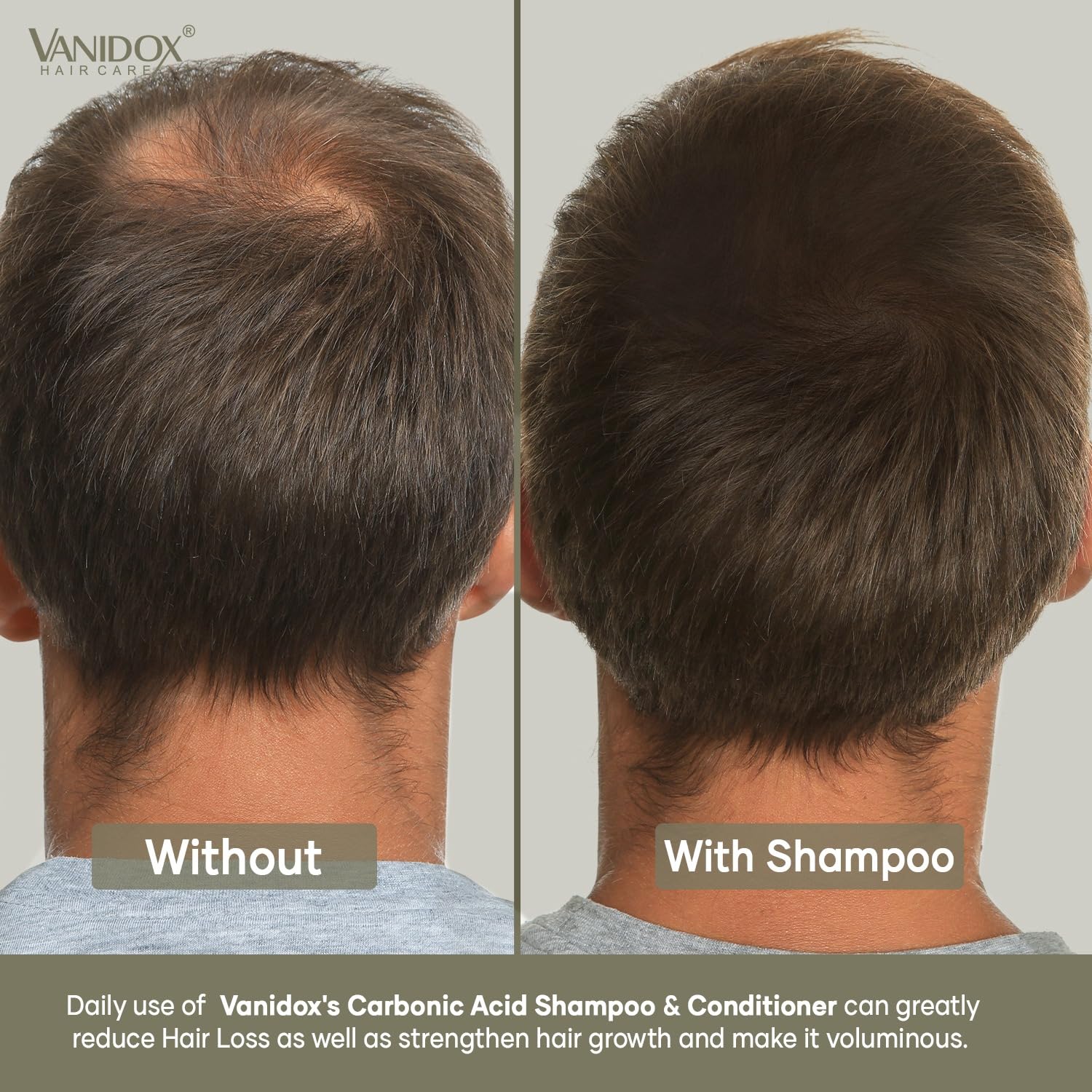 Cabello limpio y brillante tras el lavado con VANIDOX.