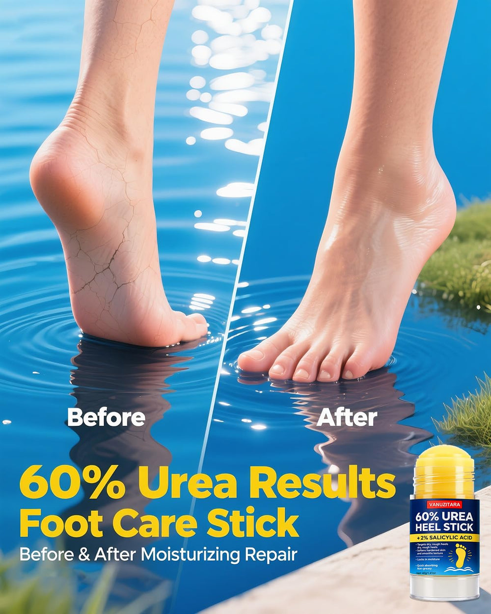 VANUZITARA Urea Stick being applied for precise, mess-free foot care.