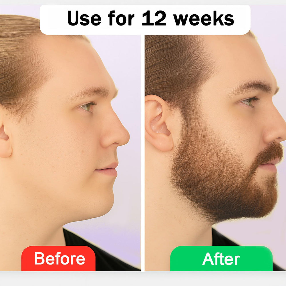 Vbolre beard balm on the face supports a healthier-looking beard.