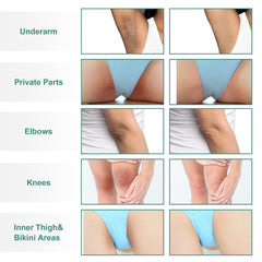 Vcetree Skin Bleaching Cream dispensing action, smooth daily application.