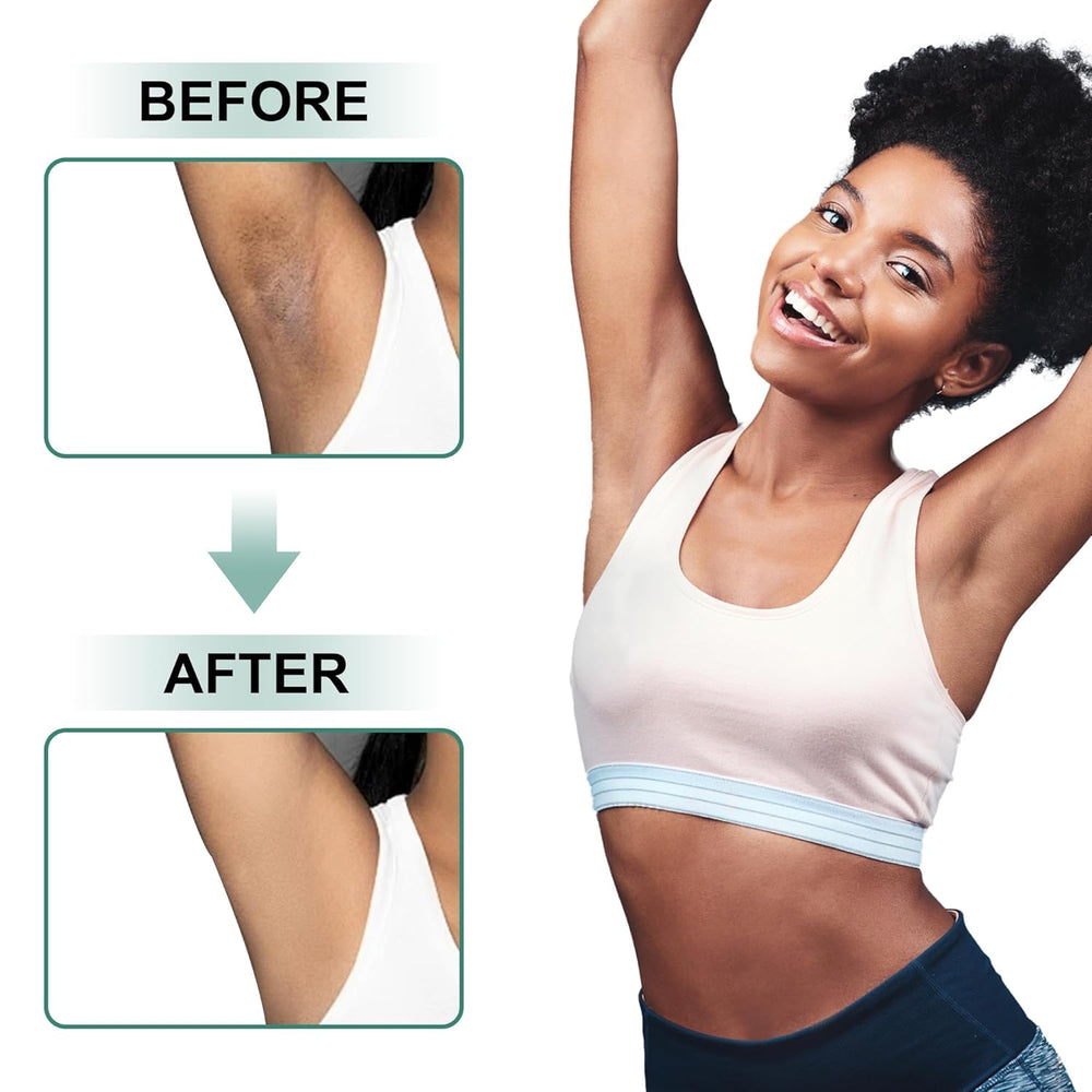 Vcetree Skin Bleaching Cream knee-elbow skin tone care.