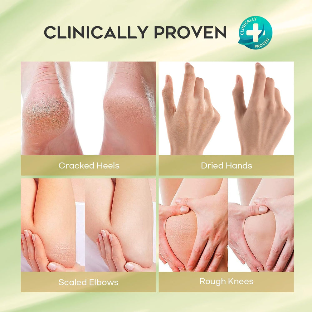 Envase de crema Urea Vebuni, práctico y fácil de usar.