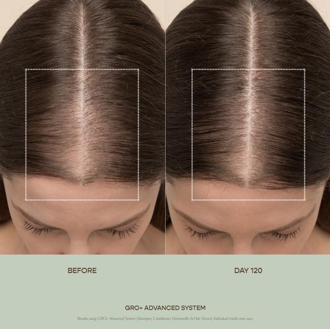 VEGAMOUR GRO+ applied to scalp for quick absorption