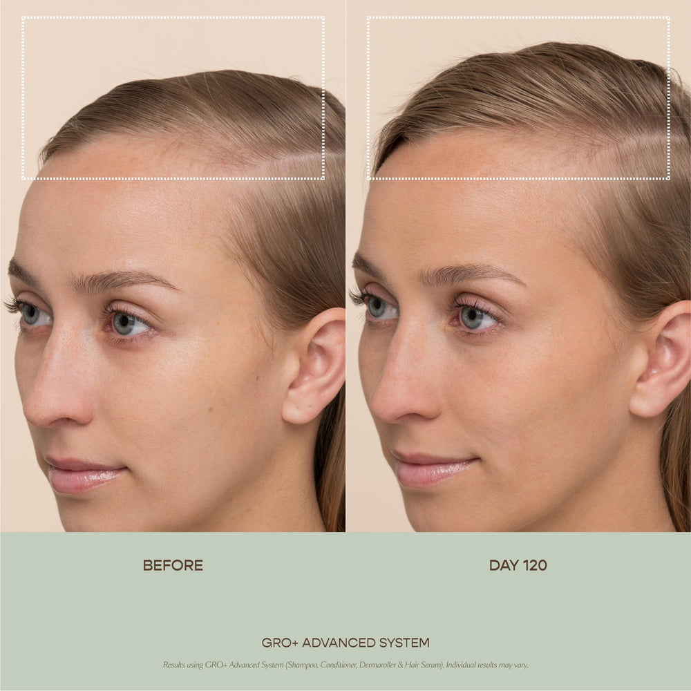 VEGAMOUR GRO+ wide-head roller ready for quick scalp coverage