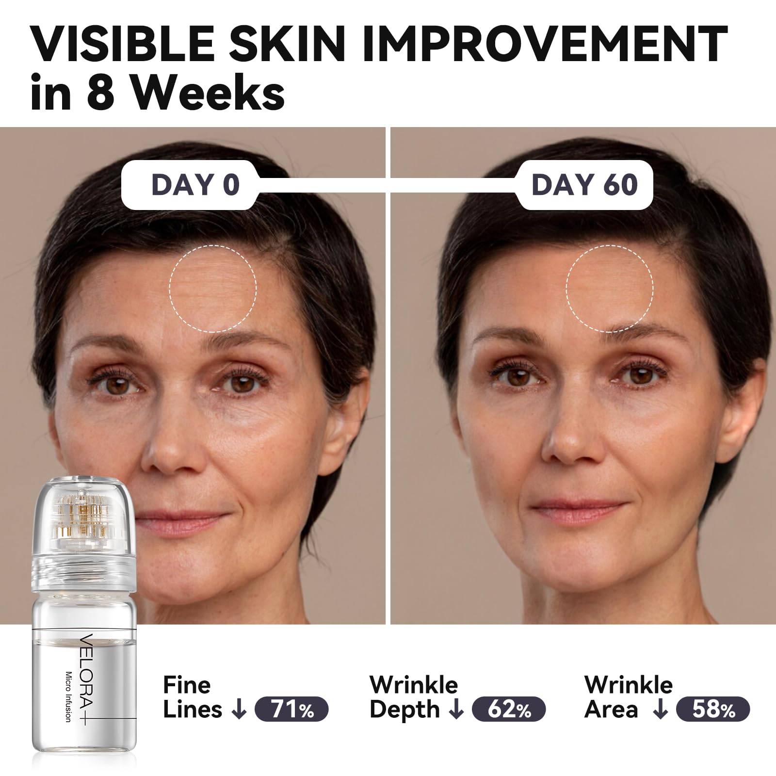 VELORA Monthly skin set packaging with two ampoules and stamps.