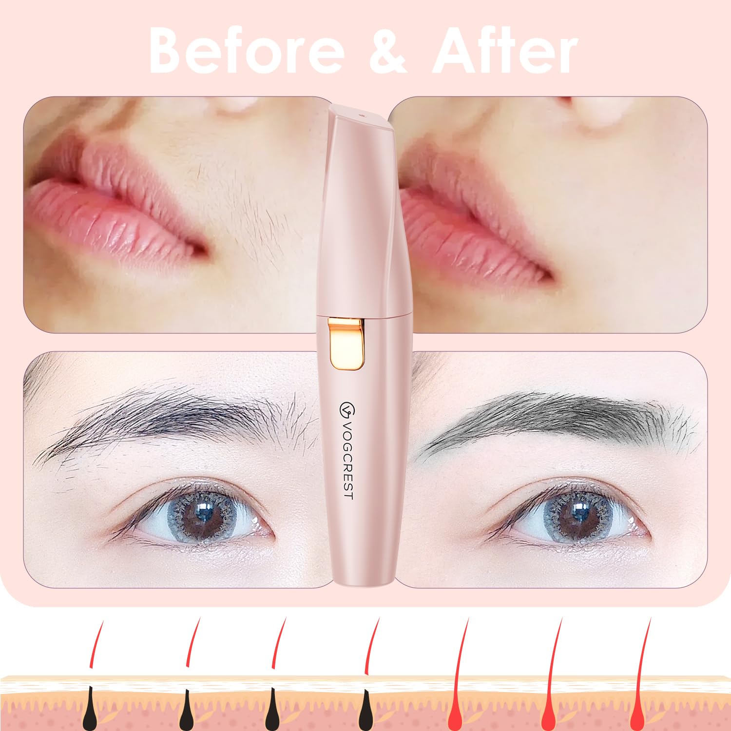 VG VOGCREST pink design hair remover for easy daily peach fuzz grooming.