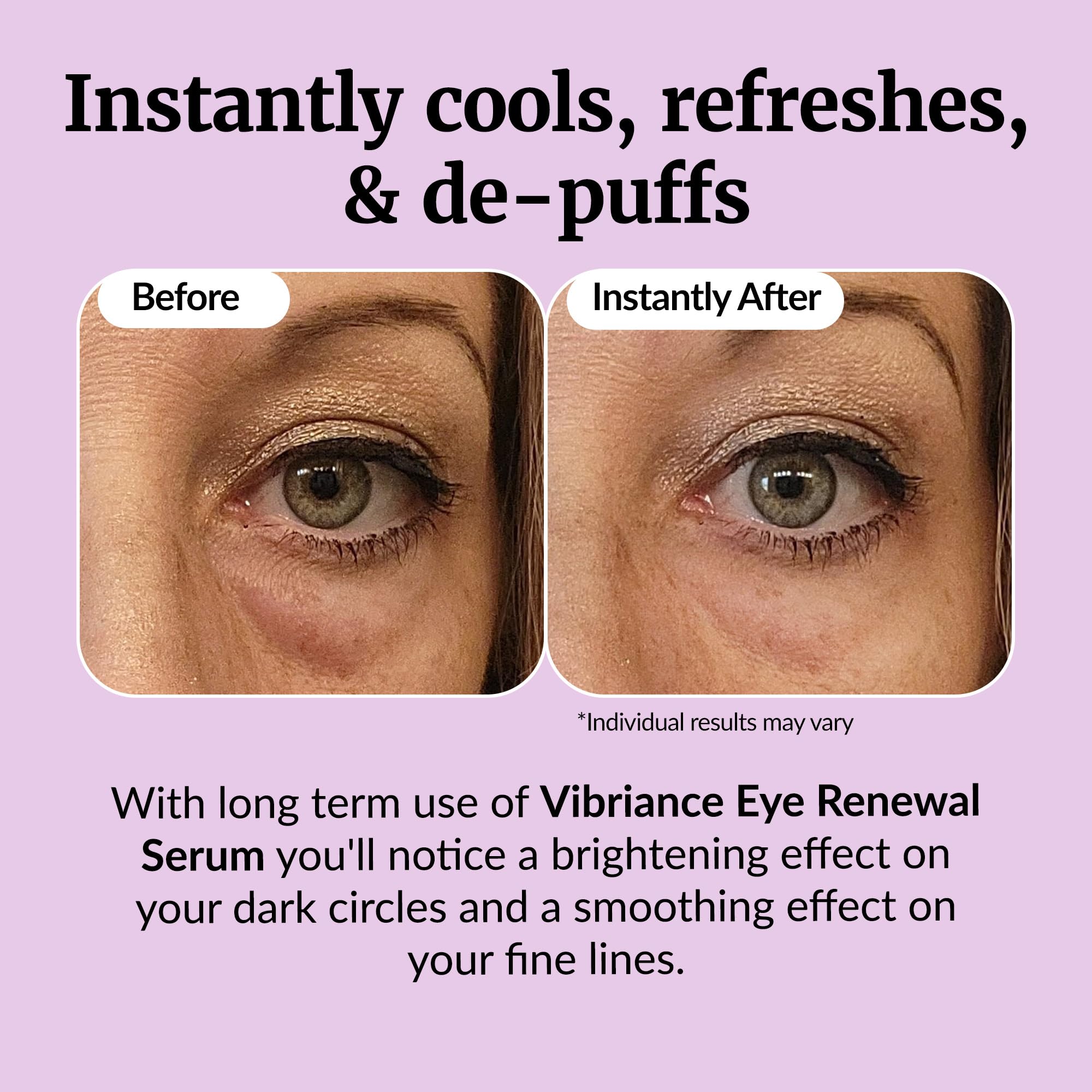 Premium packaging of Vibriance Eye Renewal Serum for a luxe routine.