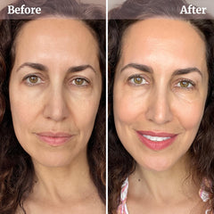 Vibriance hyaluronic acid hydration for moisturized skin.