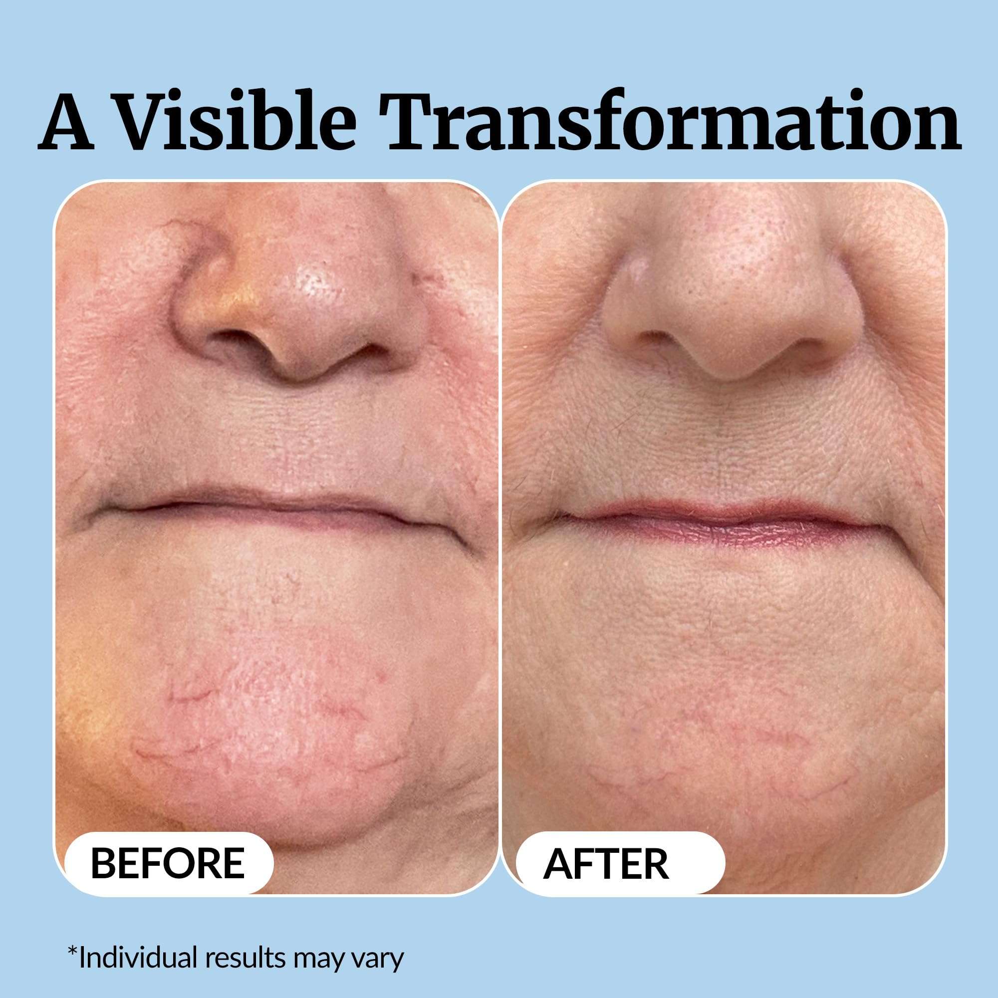 Vibriance Super C Serum hydration glow reveals refreshed, radiant skin