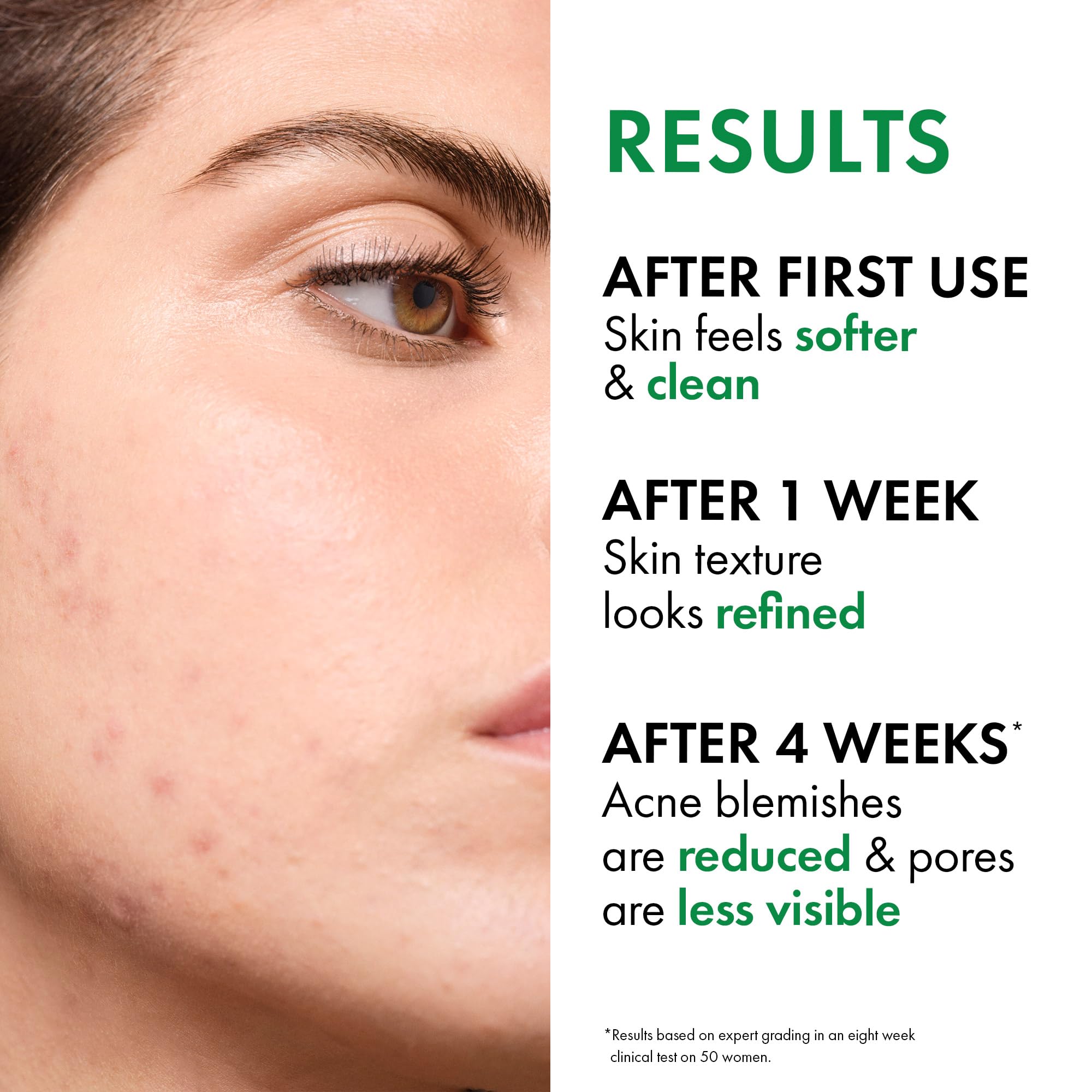Close-up of 2% salicylic acid in Vichy Normaderm formula for exfoliation.