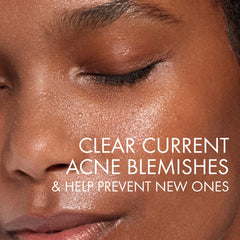 VICHY Normaderm: textura de gel transparente que forma espuma suave.