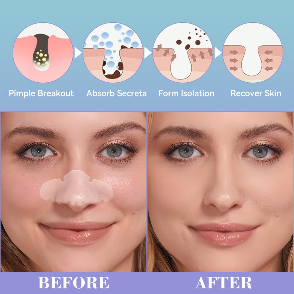 Vigorder Nose Pore Patch being applied to the nose for targeted care