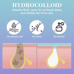 Vigorder patch turning white as pores are cleansed