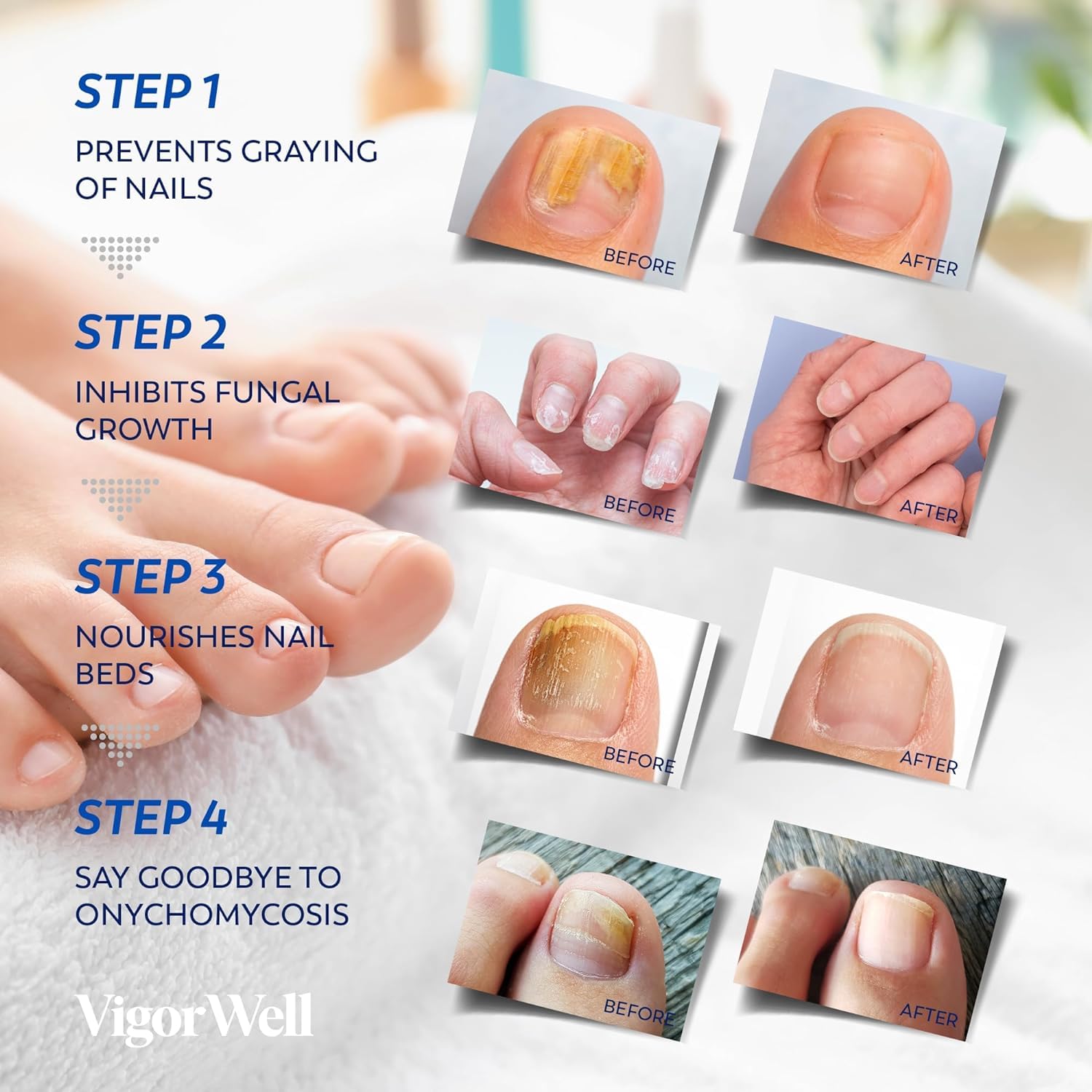 Restauración de uñas dañadas con VigorWell para uso diario.