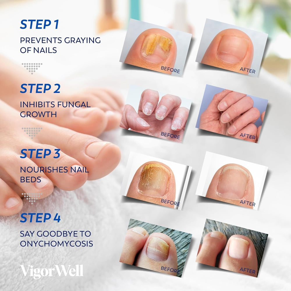 Restauración de uñas dañadas con VigorWell para uso diario.