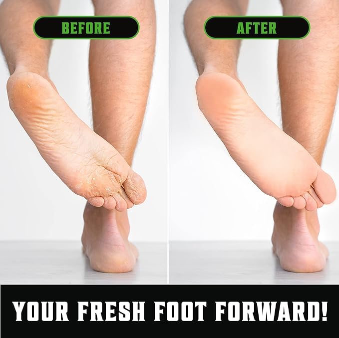 Viking Revolution Tea Tree Oil Body Wash supports post-workout skin comfort.