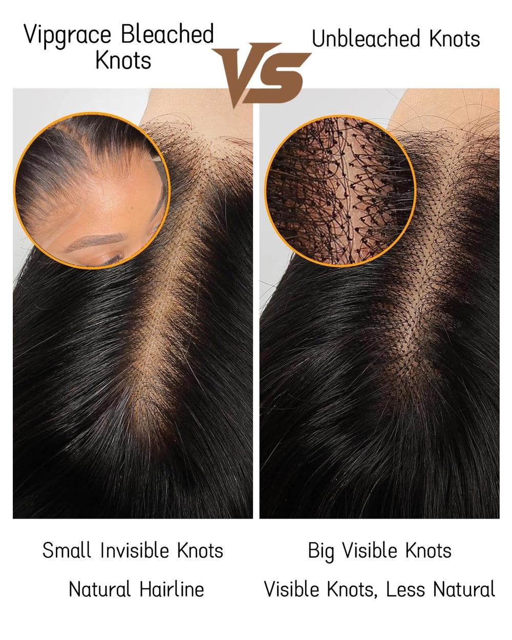 Vipgrace natural-looking hairline on model for daily use