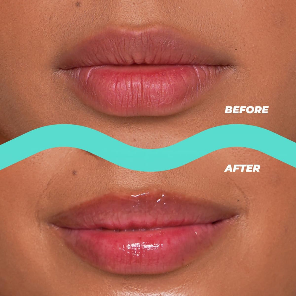 Close-up of Vitamasques lip butter balm texture for rich nourishment.