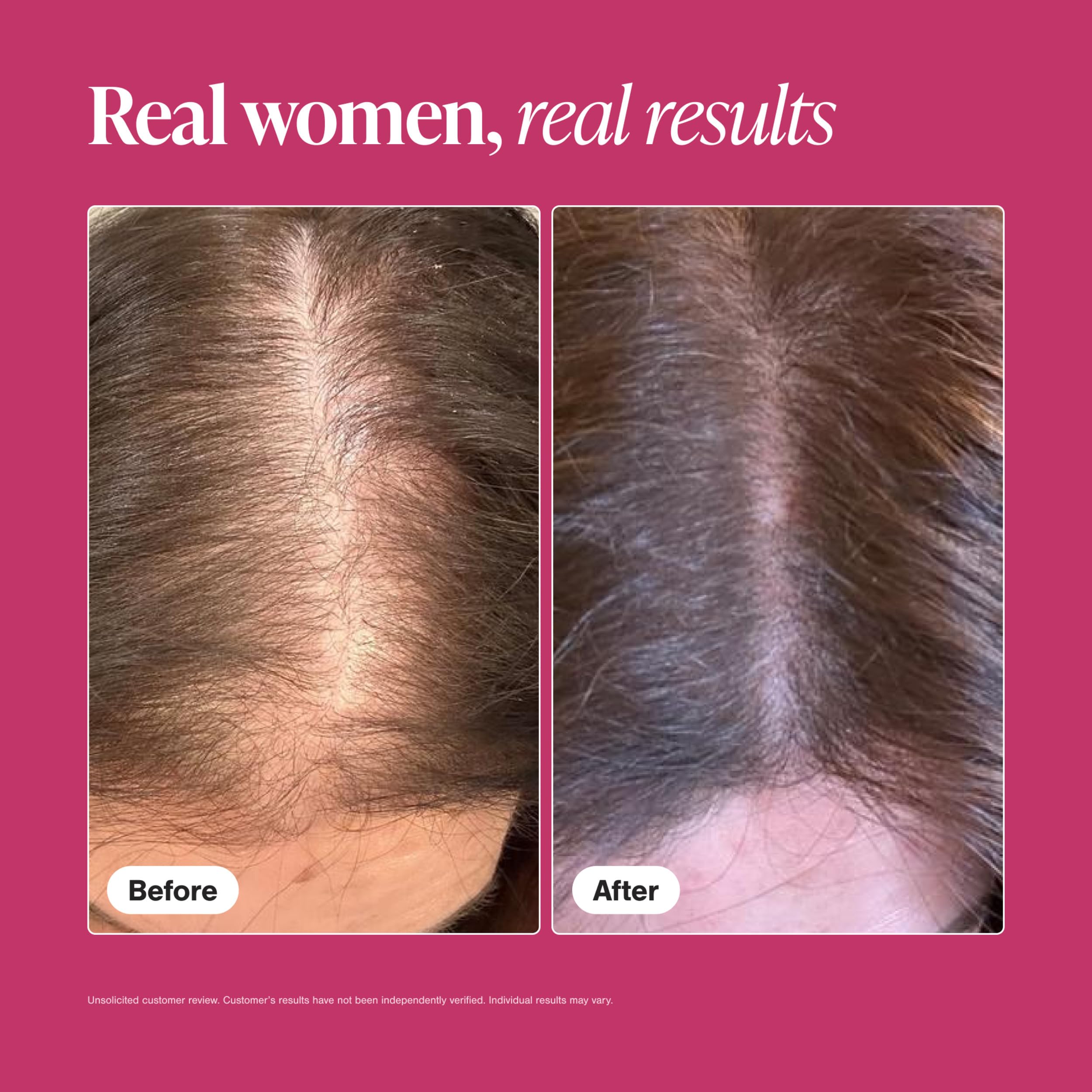 Viviscal vitamins with biotin zinc iron for essential nutrients.