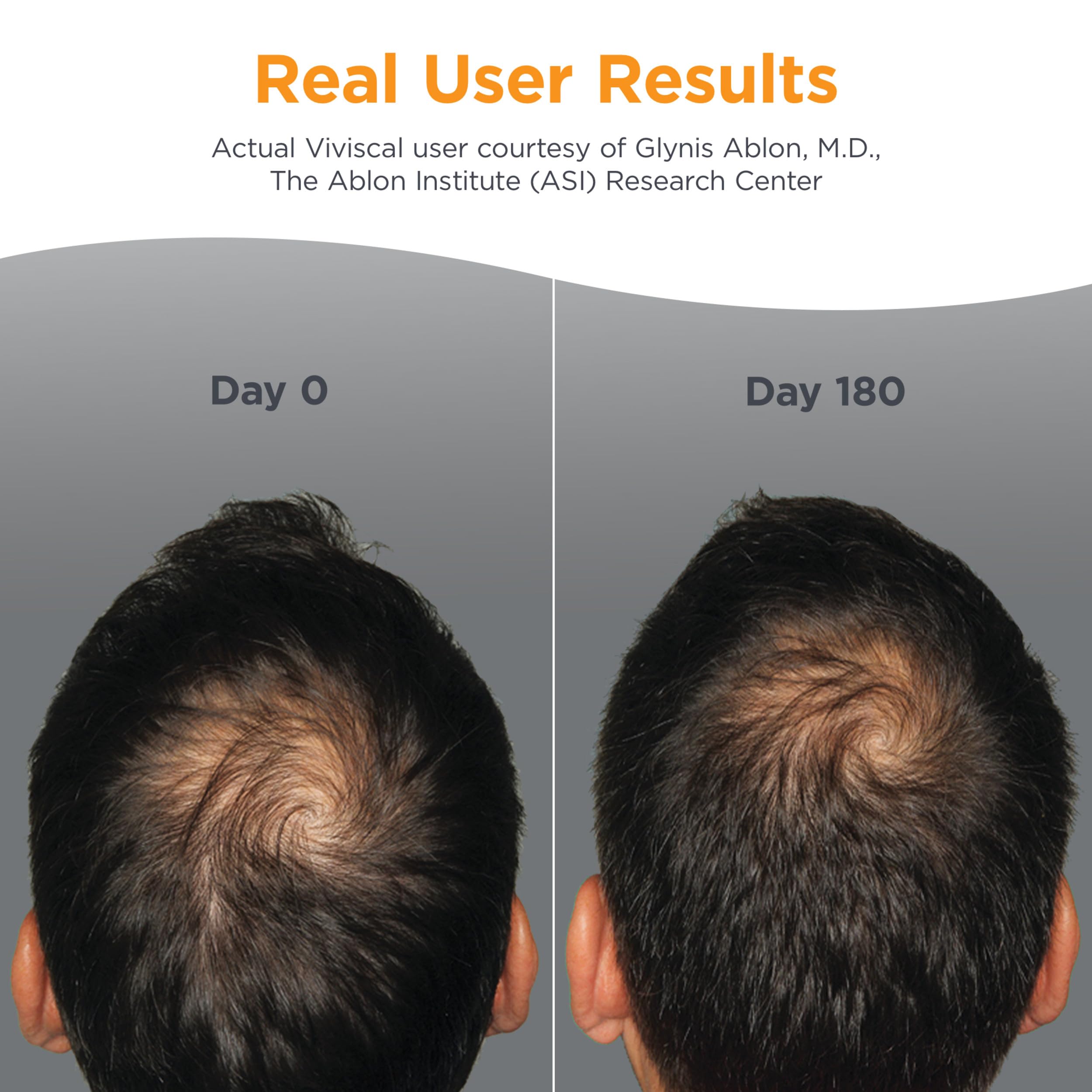 Viviscal Man tablets close-up highlighting drug-free vitamins for thinning hair.