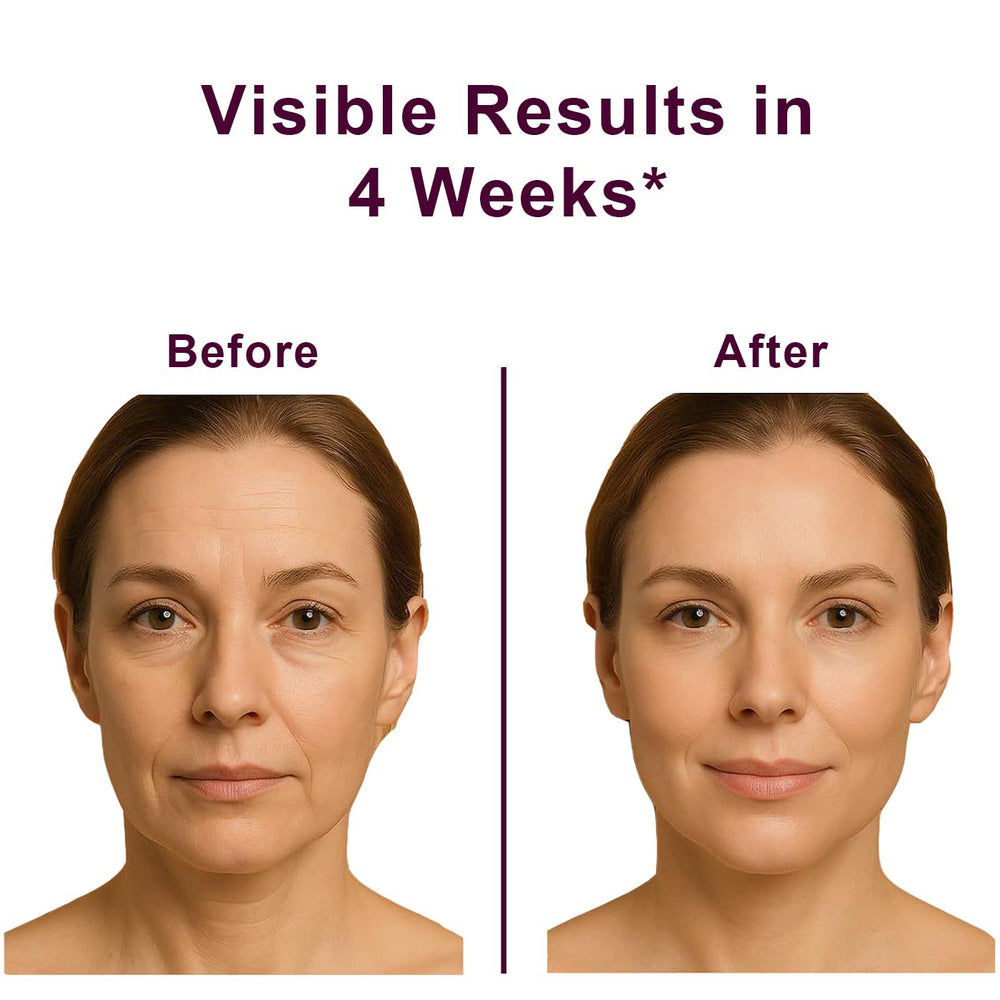 VKSpoa Wrinkle Bounce ojos: suaviza líneas finas en el contorno.