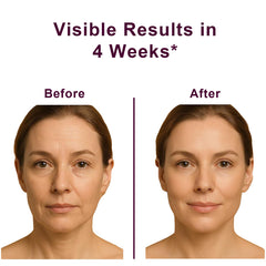 VKSpoa Wrinkle Bounce ojos: suaviza líneas finas en el contorno.