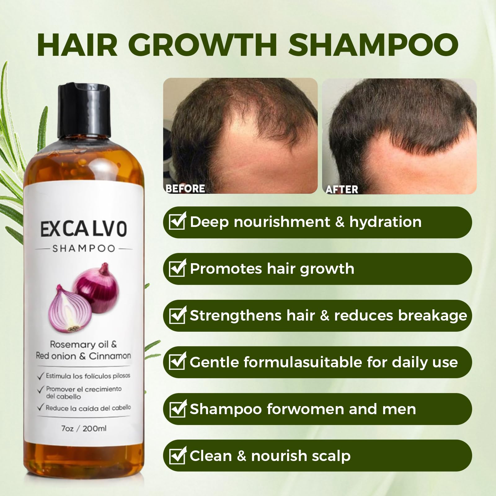 Vlsdoin Excalvo Shampoo: uso diario para cabello limpio y manejable.