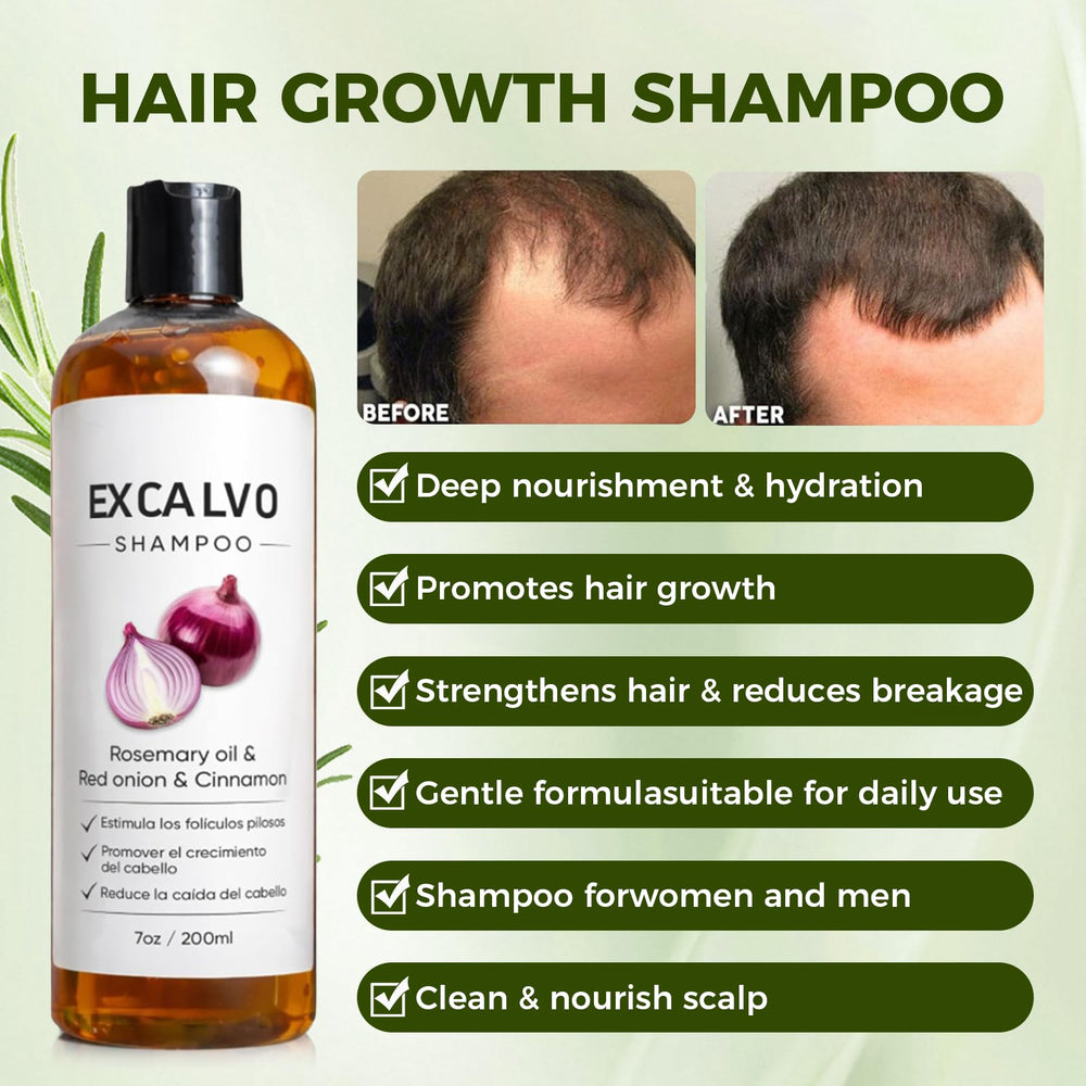 Vlsdoin Excalvo Shampoo: uso diario para cabello limpio y manejable.