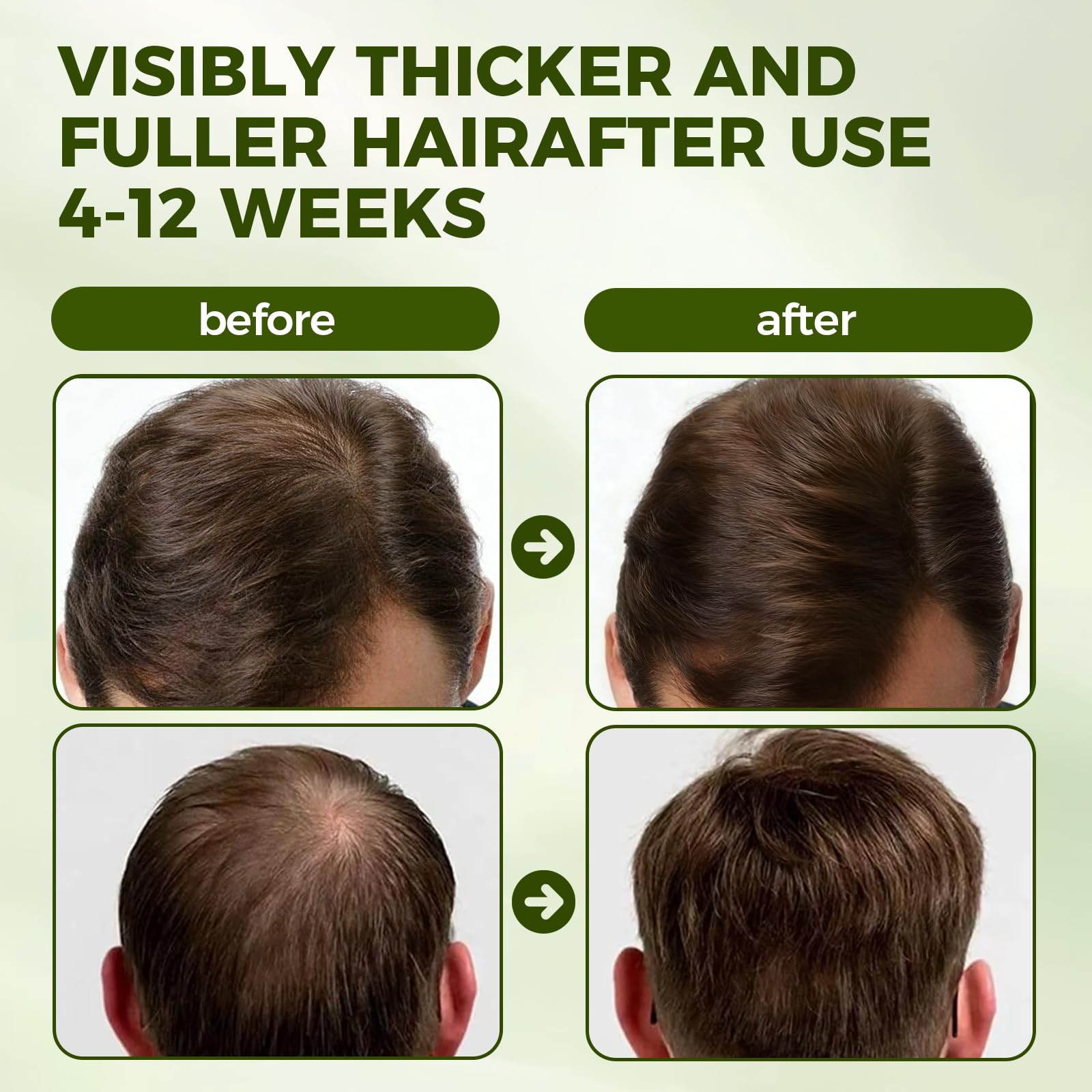 Vlsdoin Excalvo Shampoo: opción versátil para cabello fino, grueso, liso o rizado.