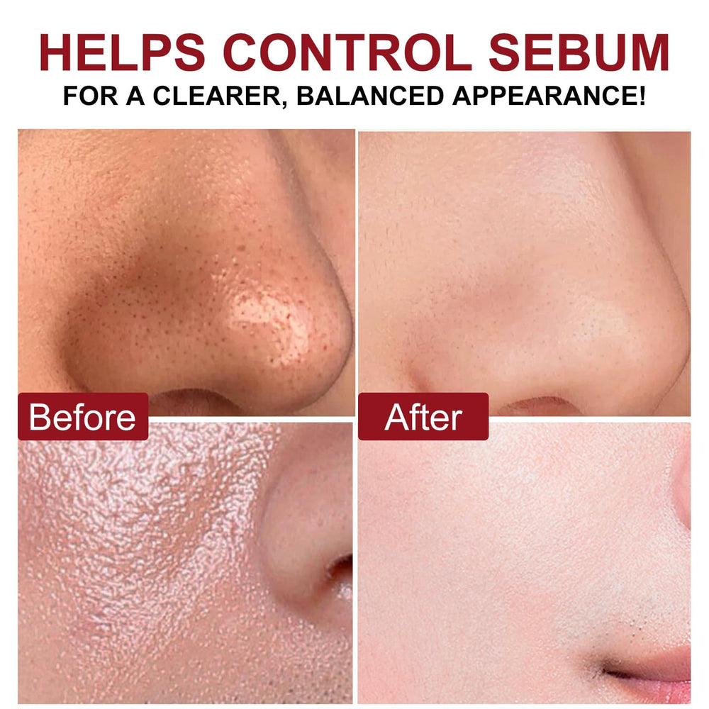 VOFANK Exfoliante Hidratación con barrera para piel hidratada