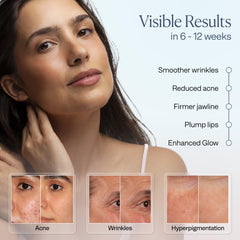 VogueNow LuminX Pro chin coverage lights the jawline for a lifted look.