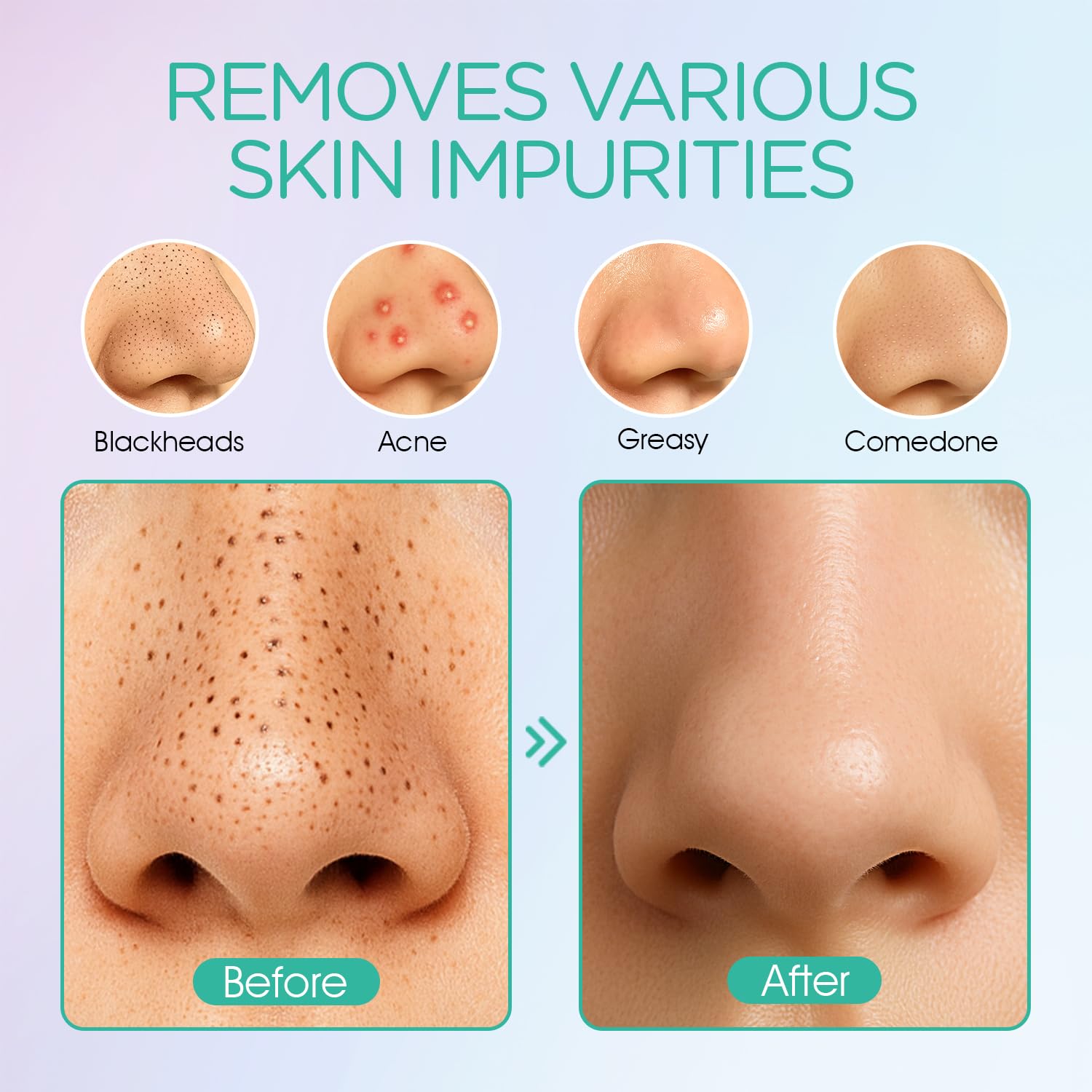 VOYOR small suction head targets stubborn blackheads on the nose.