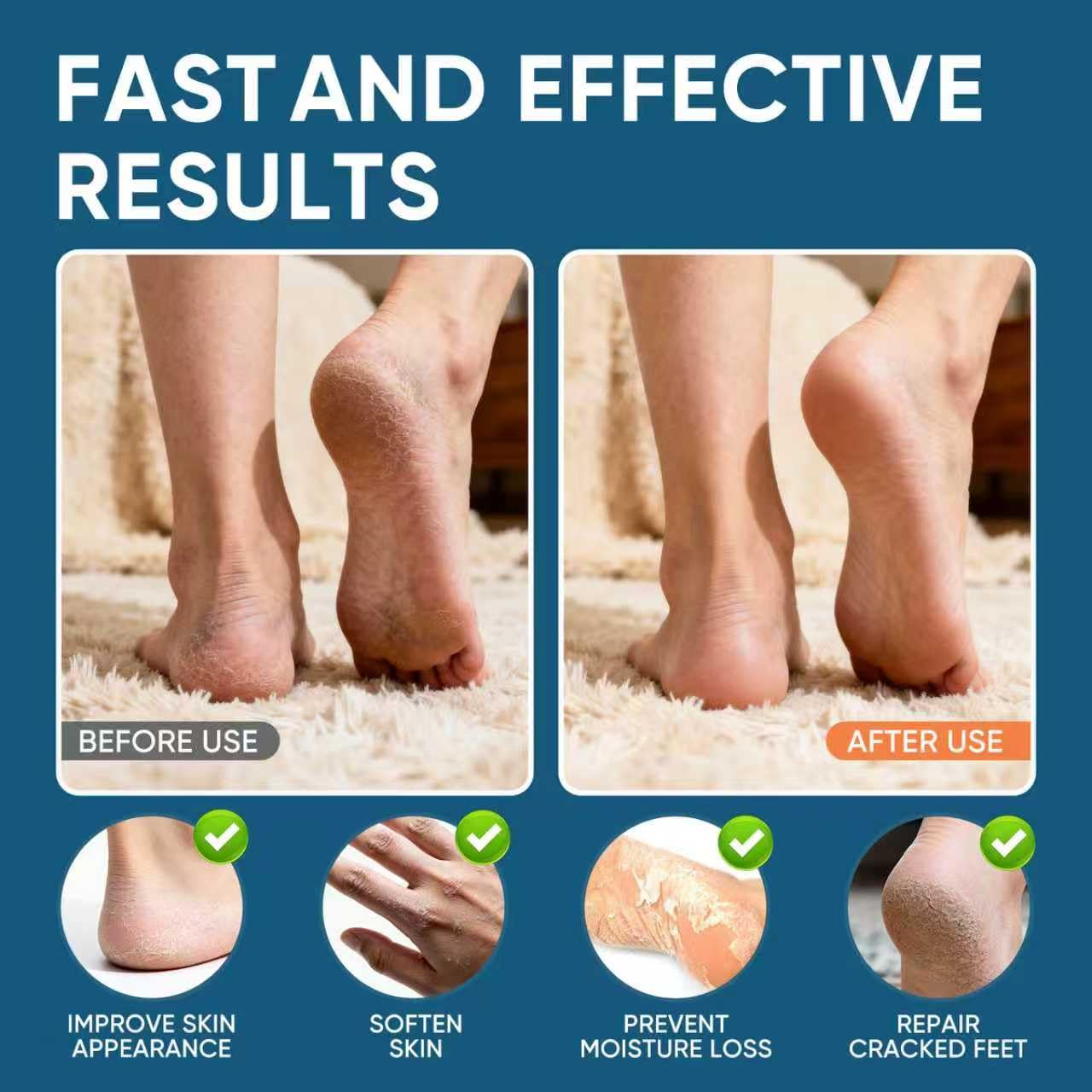 VREKEF Crema Urea 60% en acción, aplicación diaria y rápida absorción.