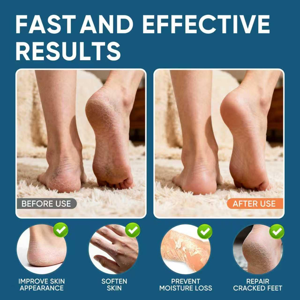 VREKEF Crema Urea 60% en acción, aplicación diaria y rápida absorción.