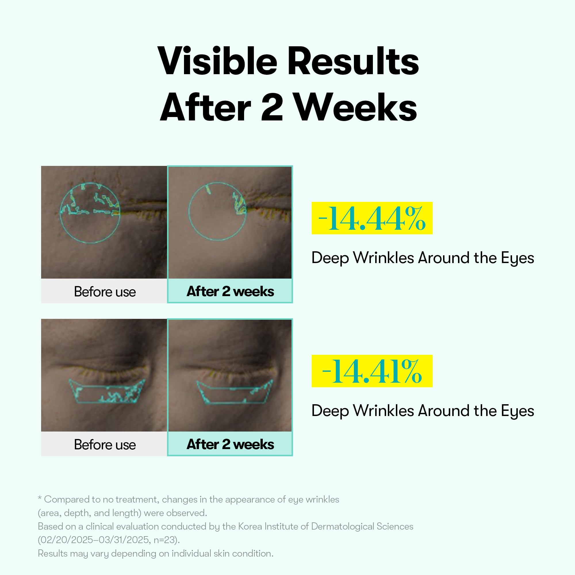 VT COSMETICS PDRN Reedle Shot Eye Cream microneedling spicules close-up promoting better absorption.