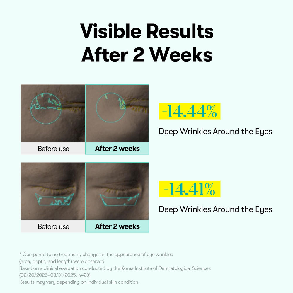 VT COSMETICS PDRN Reedle Shot Eye Cream microneedling spicules close-up promoting better absorption.