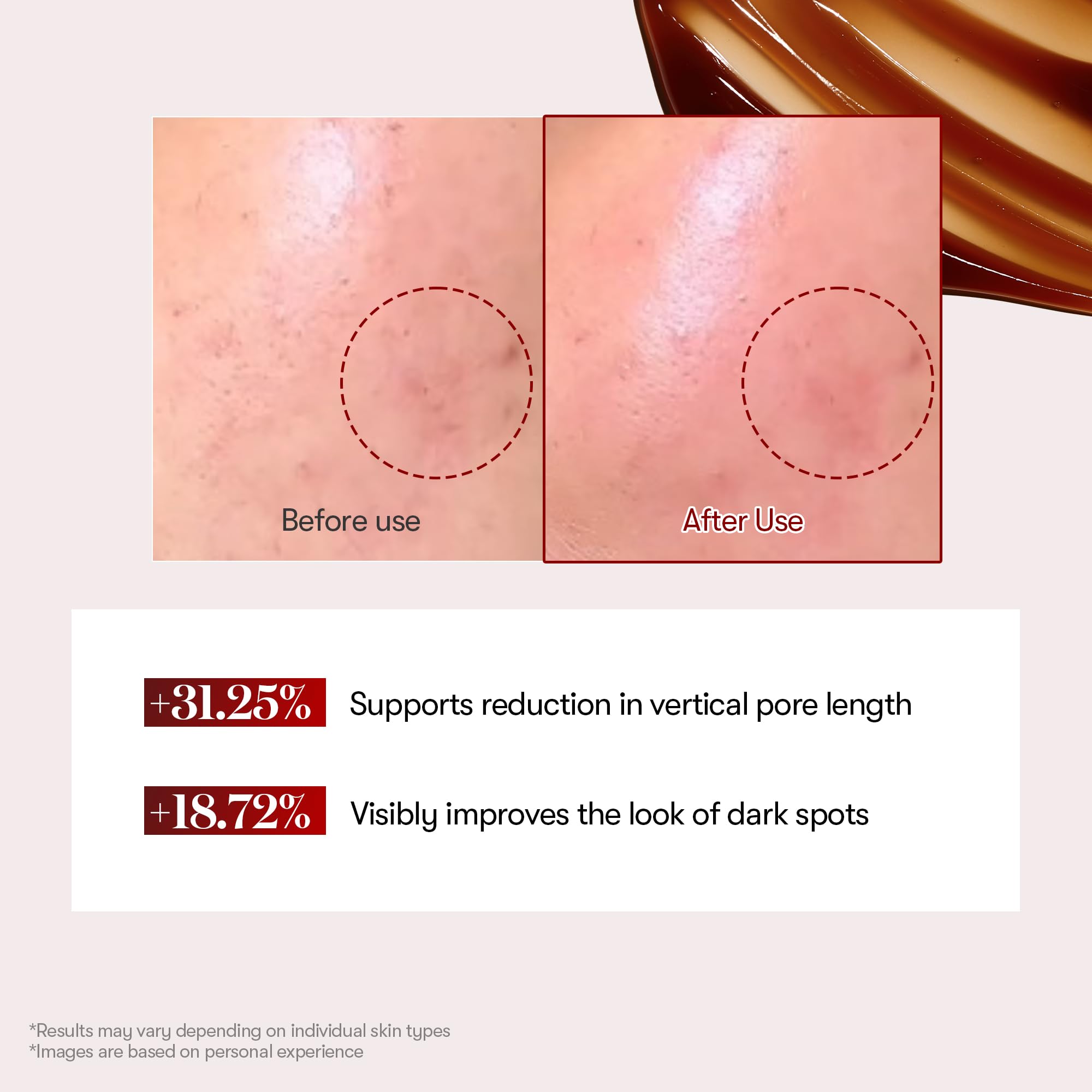 VT COSMETICS Reedle Shot after sun calms redness