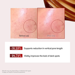 VT COSMETICS Reedle Shot after sun calms redness