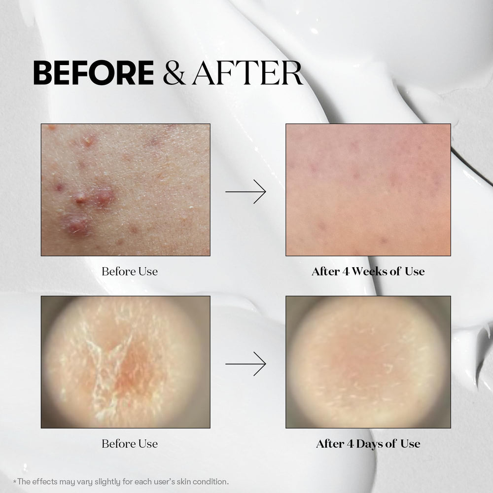VT COSMETICS Reedle Shot 700 bottle revitalizes vitality and glow
