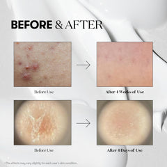 VT COSMETICS Reedle Shot 700 bottle revitalizes vitality and glow