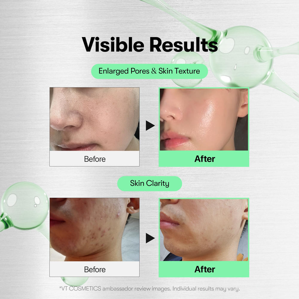 VT COSMETICS Reedle Shot micro-needling action indicates improved absorption.