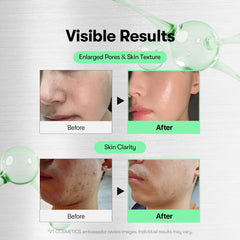 VT COSMETICS Reedle Shot micro-needling action indicates improved absorption.