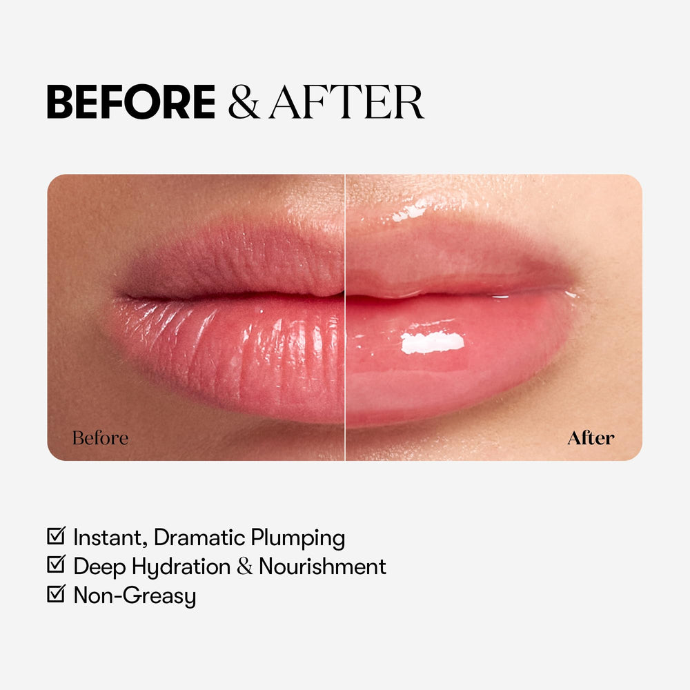 VT COSMETICS Reedle Shot Voluminizador de labios con efecto microagujas para volumen suave.