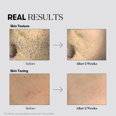 VT COSMETICS TX Toning Daily Mask close-up reveals smooth, fragrance-free formula