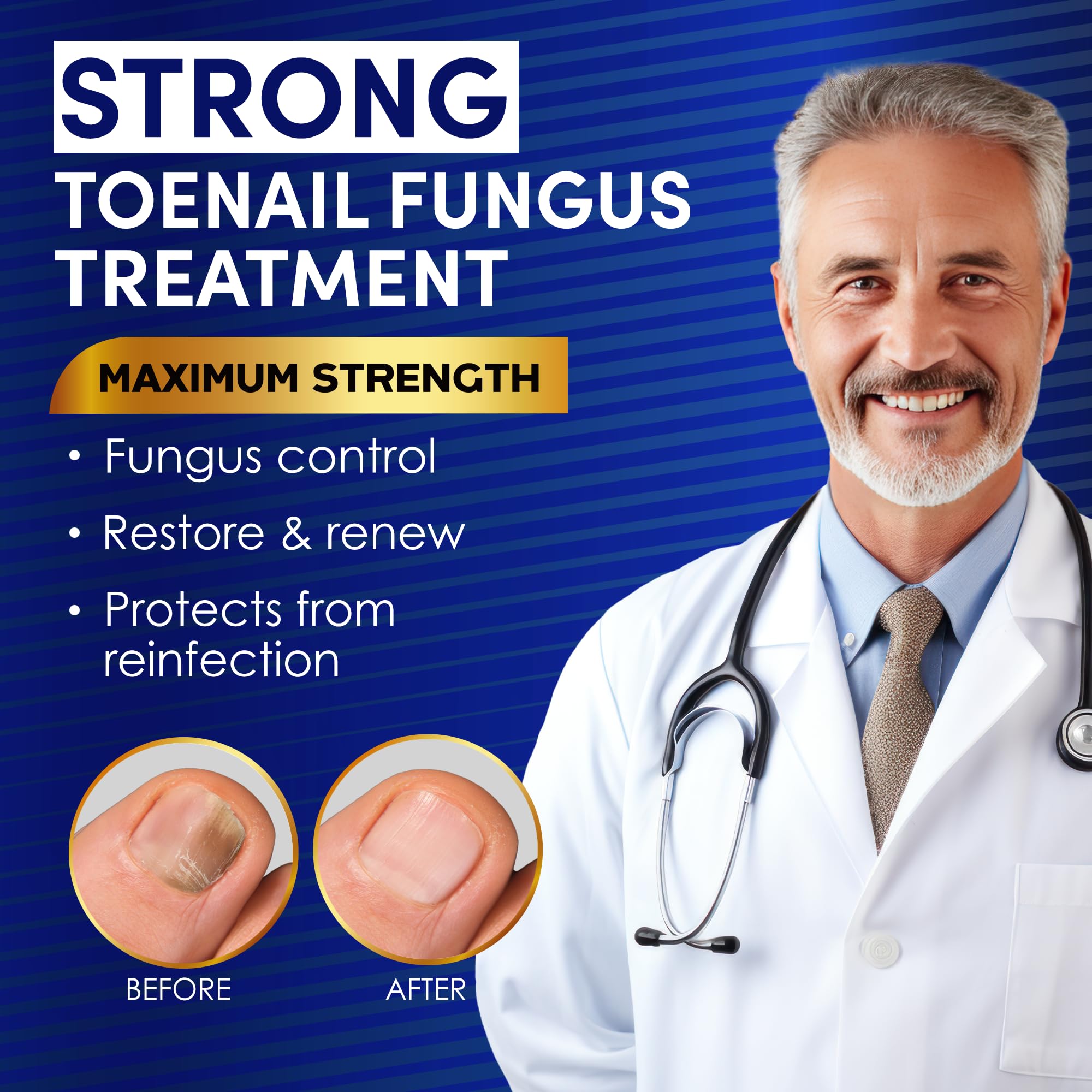 VTROUY Nail repair solution application demonstrates nail-strengthening action.