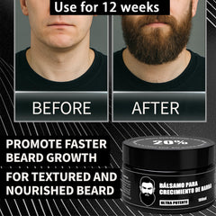 Wdvpue shea butter ingredients bottle signals moisturizing support under the beard.