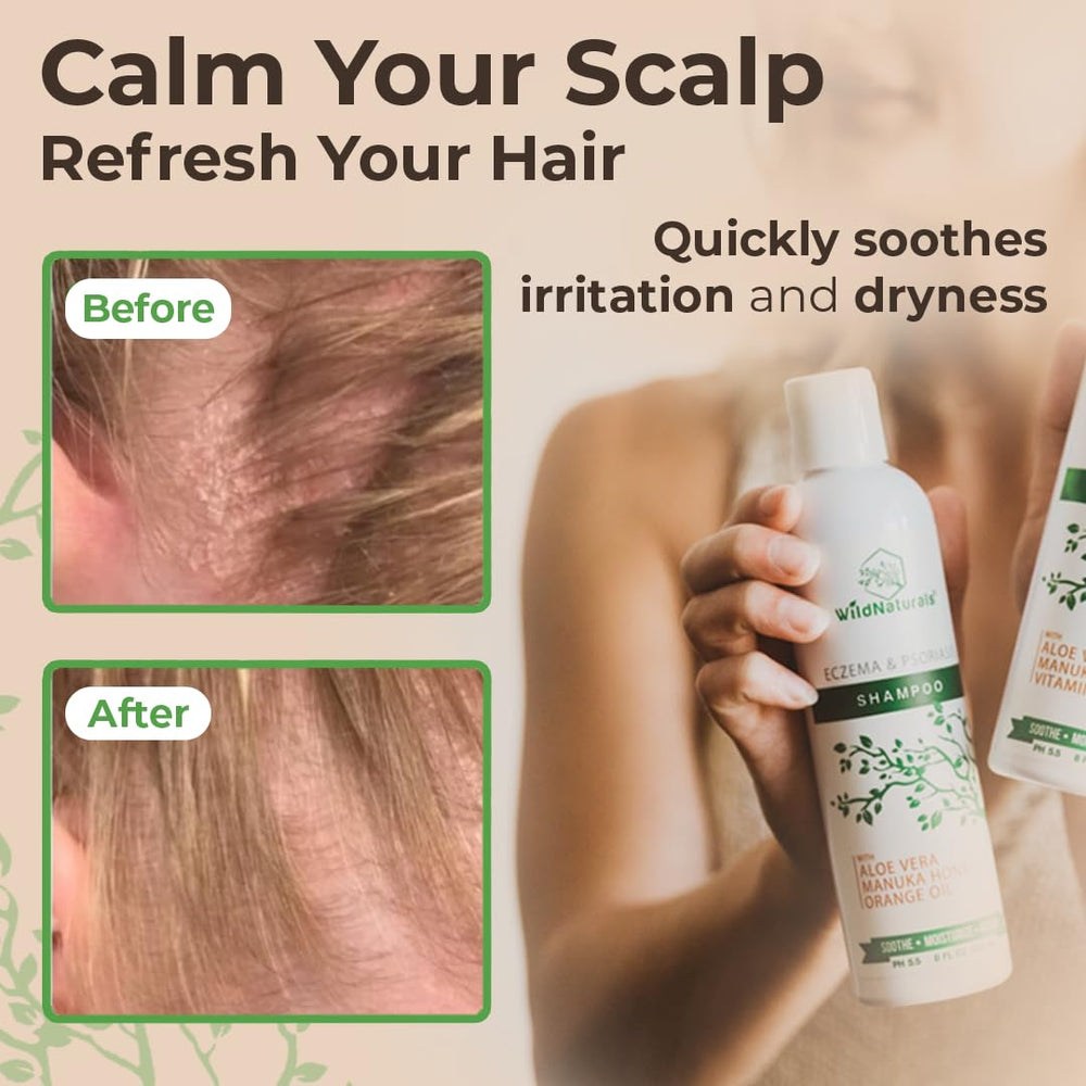 Wild Naturals etiqueta sin fragancias para cuero cabelludo sensible