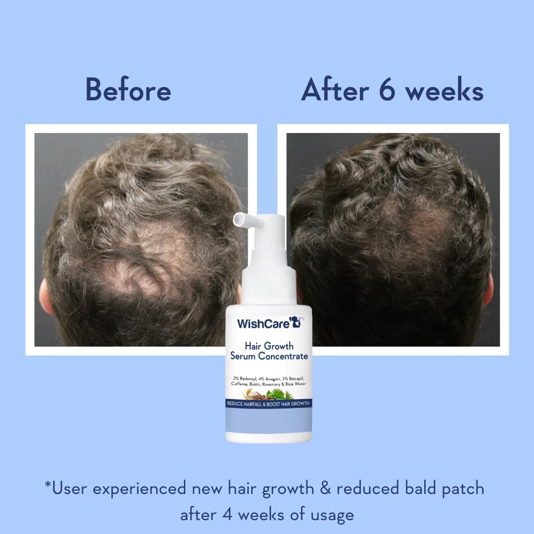 WishCare sérum crecimiento capilar en cuero cabelludo favorece sensación de frescura y cuidado.