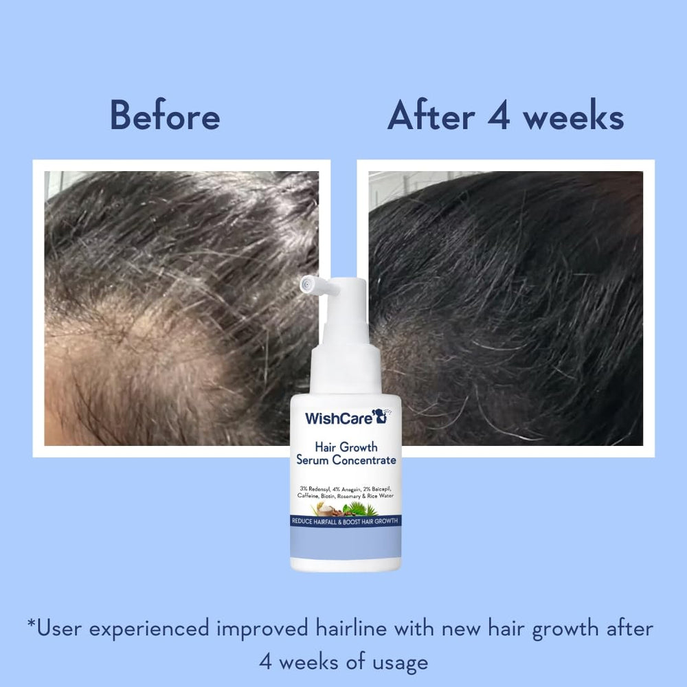 WishCare sérum crecimiento capilar, etiqueta clara para identificar beneficios clave.