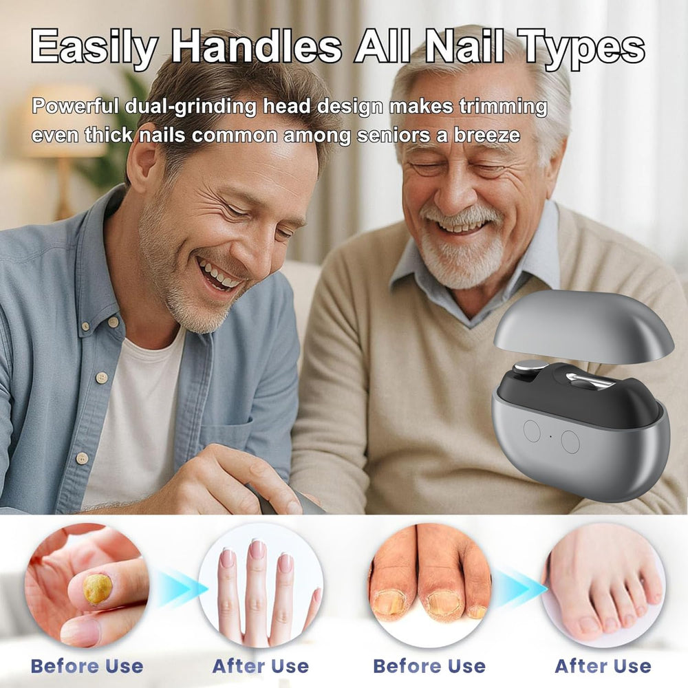 witpiny Polishing feature smooths nail edges safely